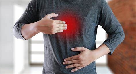 Gastroesophageal Reflux Disease